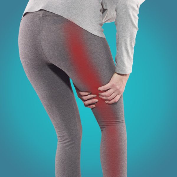 sciatica sciatica